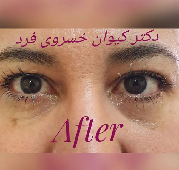 عکس پریا با کیوان