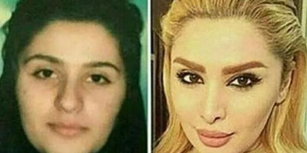عکس دنیا جهانبخت بدون عمل