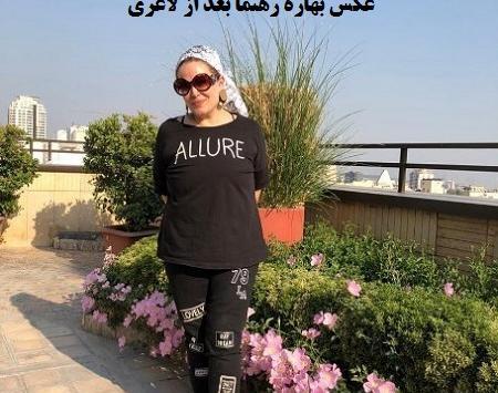 عکس بهاره رهنما بعد از لاغری
