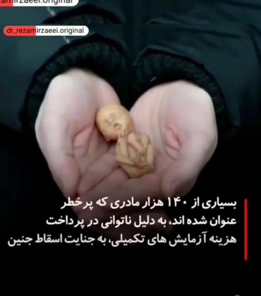 عکس فوت انصاریان