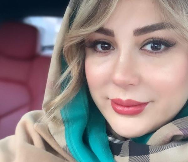 عکس نیوشا ضیغمی بعد عمل دوم