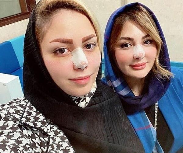 عکس نیوشا ضیغمی بعد عمل دوم