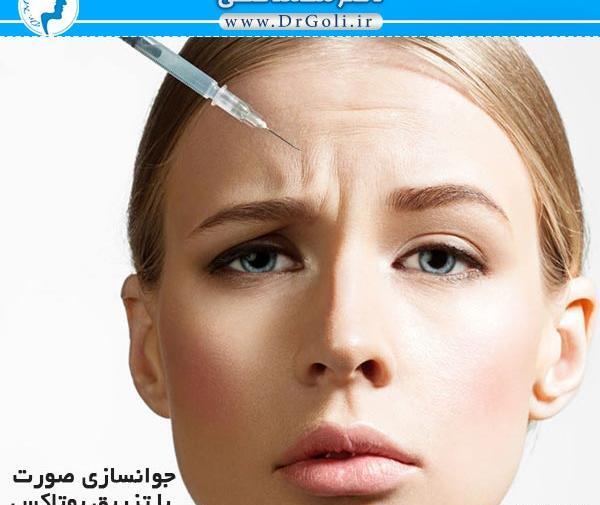عکس بوتاکس صورت