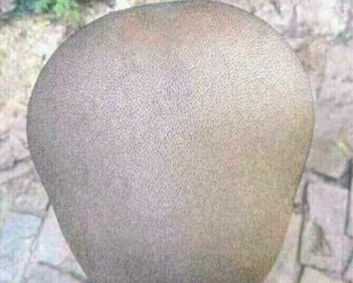 عکس خنده دار کچل