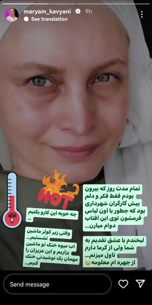 عکس زن صورت سوخته