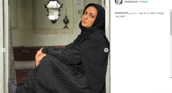 عکس زن صورت سوخته
