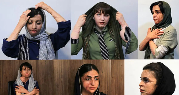 عکس زن صورت سوخته