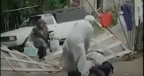 عکس زن صورت سوخته