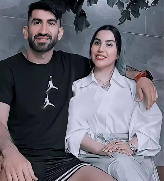 عکس همسر ترامپ قبل از عمل زیبایی