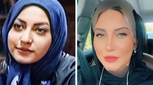 عکس همسر ترامپ قبل از عمل زیبایی