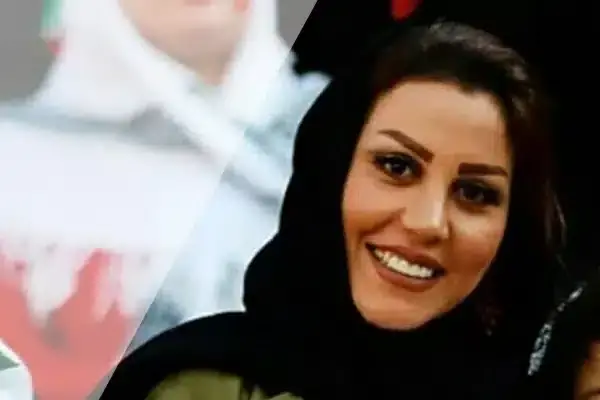 عکس همسر ترامپ قبل از عمل زیبایی