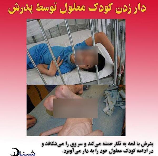 عکس ساناز کودک ۱۷ ماهه