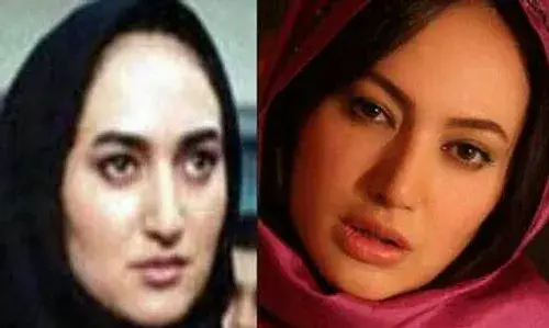 عکس قبل عمل صبا کمالی