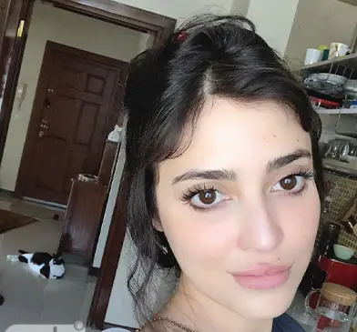 عکس قبل عمل زلیخا