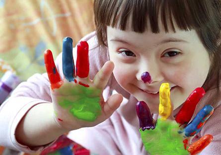 عکس نوزاد سندرم داون