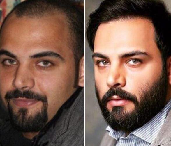 عکس احسان فروزش
