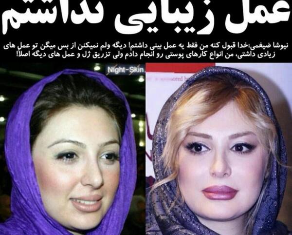 عکس آیشواریا قبل از عمل زیبایی