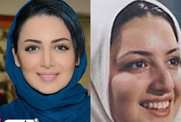 عکس آیشواریا قبل از عمل زیبایی