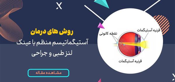 عکس چشم آستیگمات