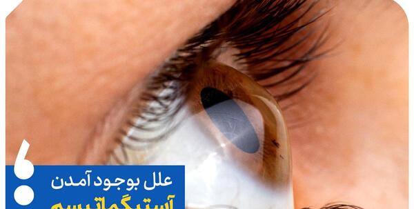 عکس چشم آستیگمات