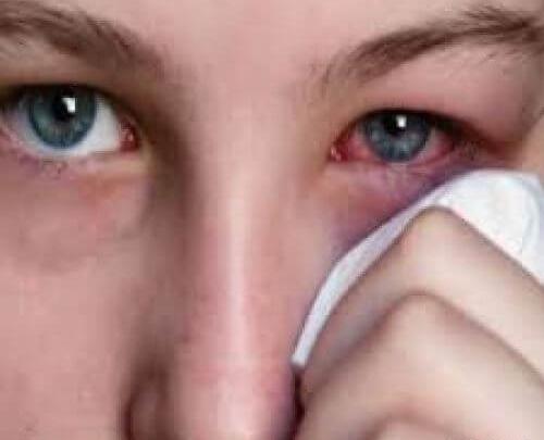 عکس چشم قرمز شده از گریه