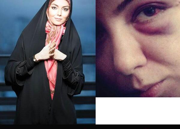 عکس همسر سابق فرزاد حسنی