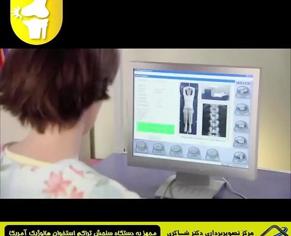عکس جنین پسر در هفته شانزدهم