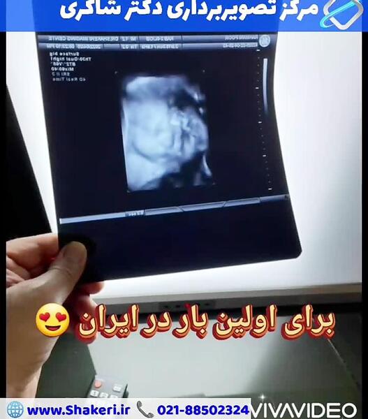 عکس جنین پسر در هفته شانزدهم