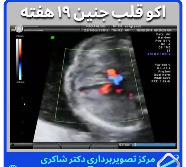 عکس جنین پسر در هفته شانزدهم