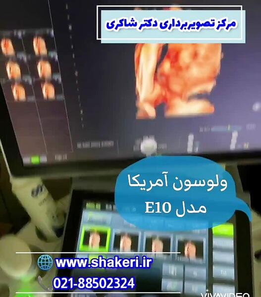 عکس جنین پسر در هفته شانزدهم