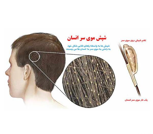 عکس پودر شپش