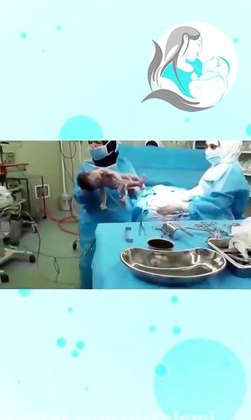 عکس رحم در حال زایمان طبیعی