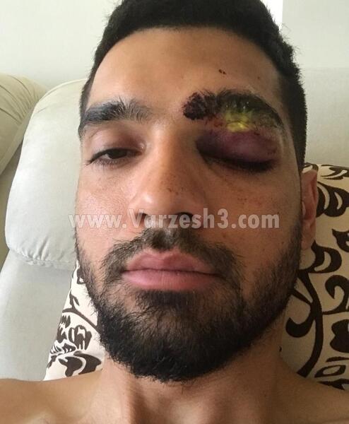 عکس مهدی مهدی پور و همسرش