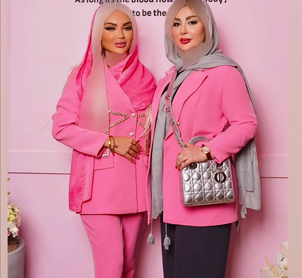 عکس باربی زنده