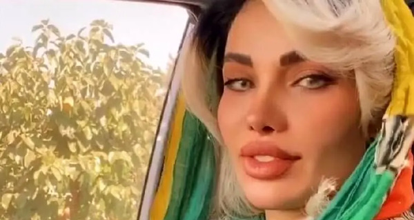 عکس همسر مهدی قائدی قبل از عمل
