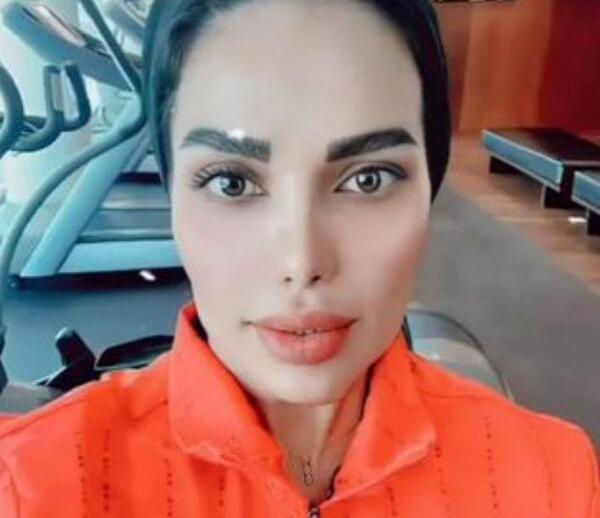 عکس همسر مهدی قائدی قبل از عمل
