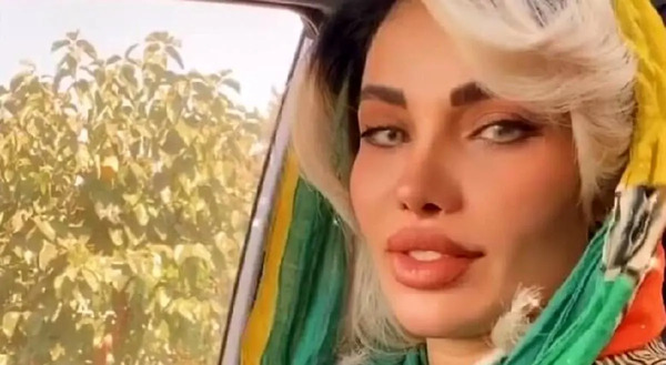 عکس همسر مهدی قائدی قبل از عمل