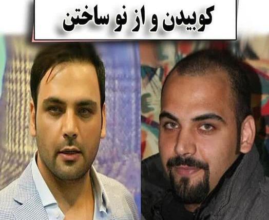 عکس های احسان علیخانی قبل از عمل