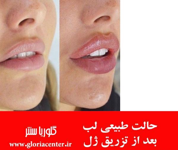 عکس بافت طبیعی
