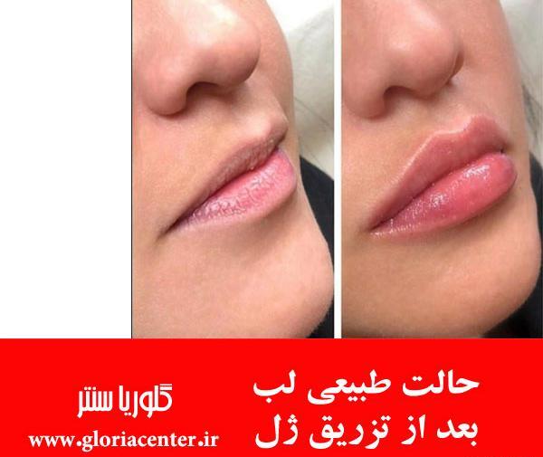 عکس بافت طبیعی