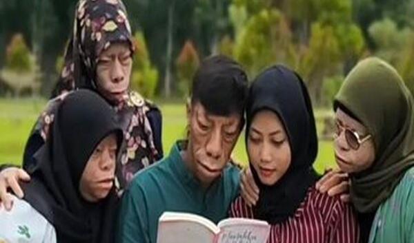 عکس پسر مارمولکی