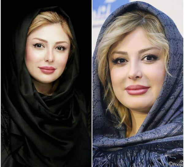 عکس کودکی نیوشا ضیغمی