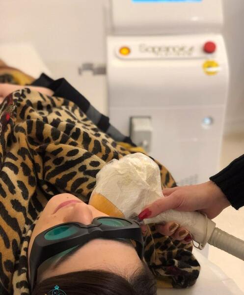 عکس دستگاه لیزر رولی