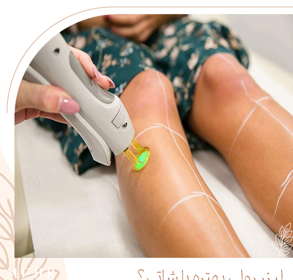 عکس دستگاه لیزر رولی