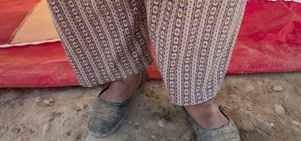 عکس دمپایی کهنه