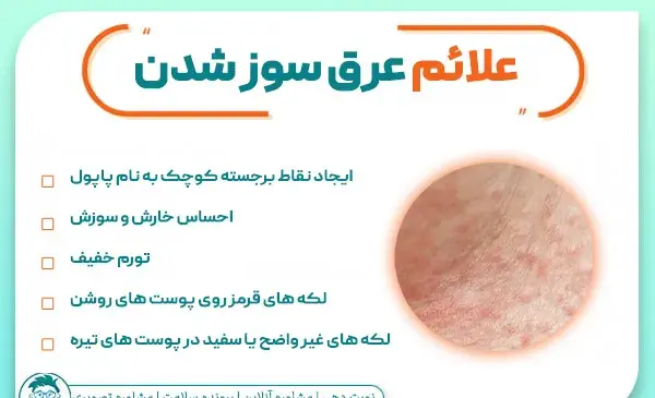 عکس عرق سوزی