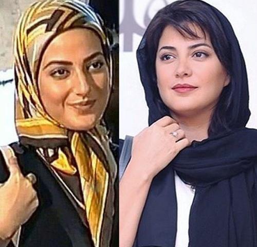 عکس زلیخا قبل از عمل جراحی
