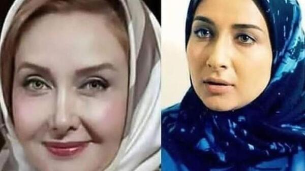 عکس زلیخا قبل از عمل جراحی