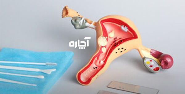 عکس جواب پاپ اسمیر سالم