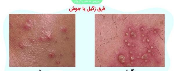 عکس جواب پاپ اسمیر سالم